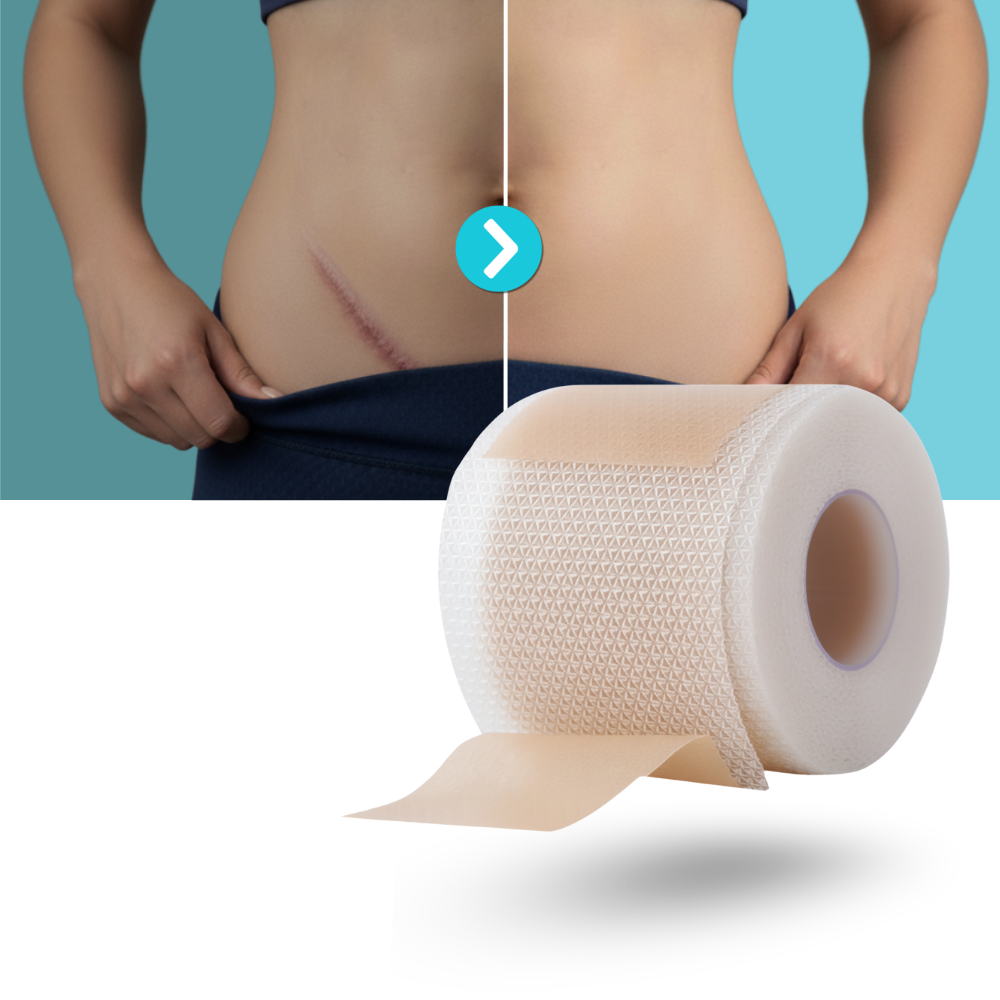 Hyaluronic Silicone Scar Patch - Ozerty