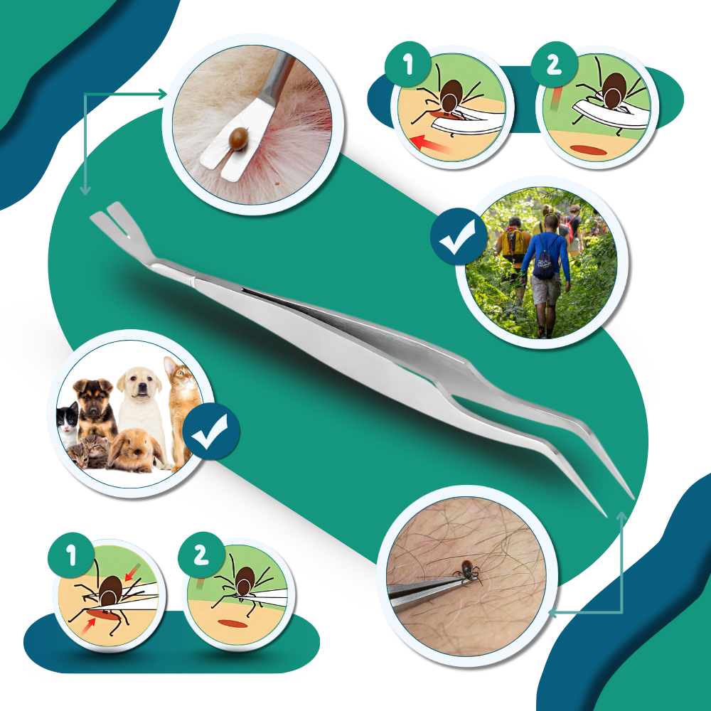 Precision Tick Extractor - Ozerty