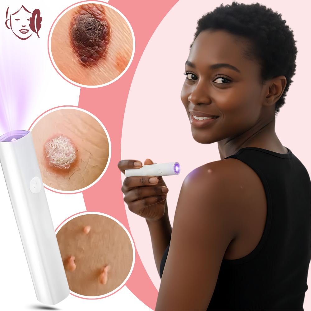 Radiance Cosmetic Laser Pen - Ozerty