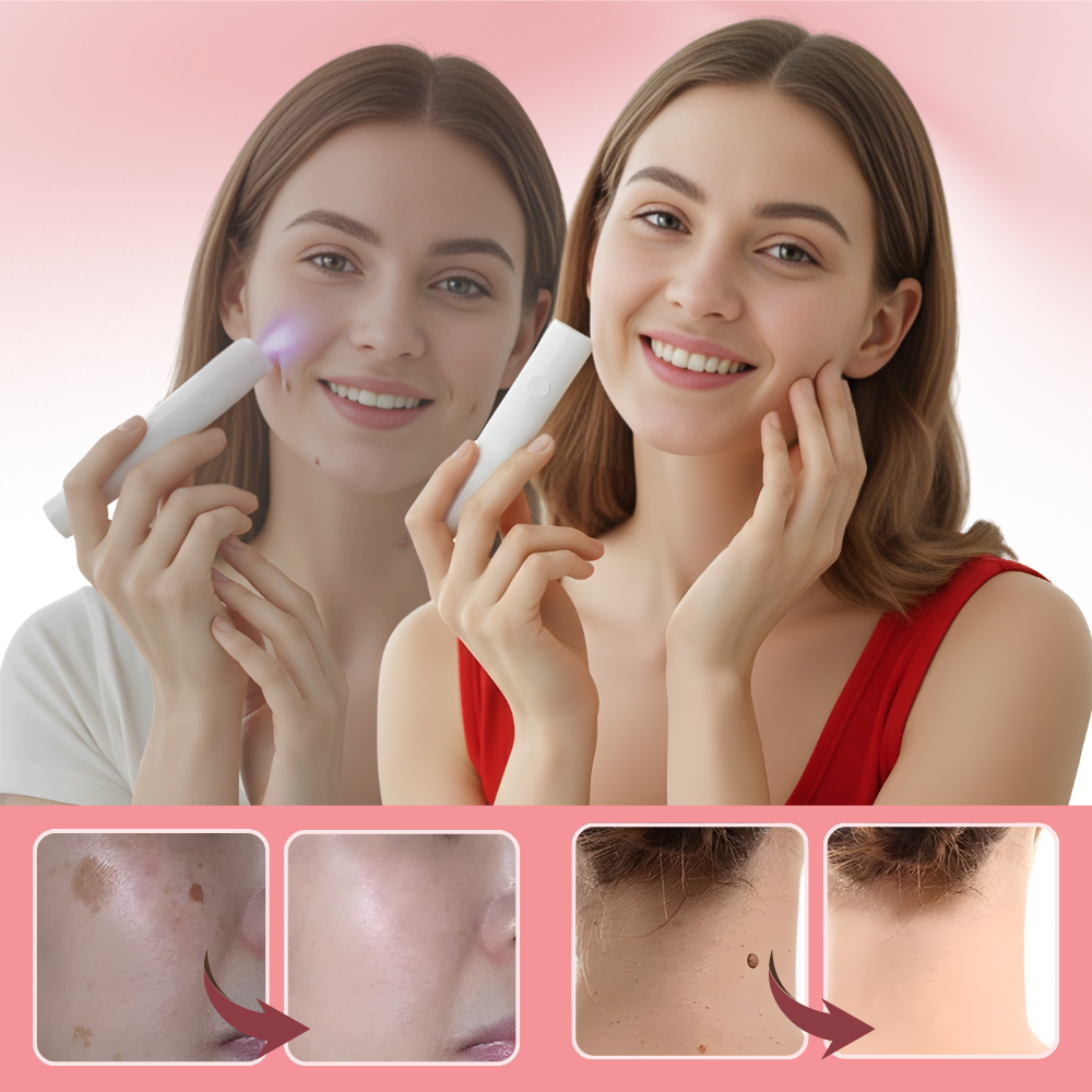 Radiance Cosmetic Laser Pen - Ozerty