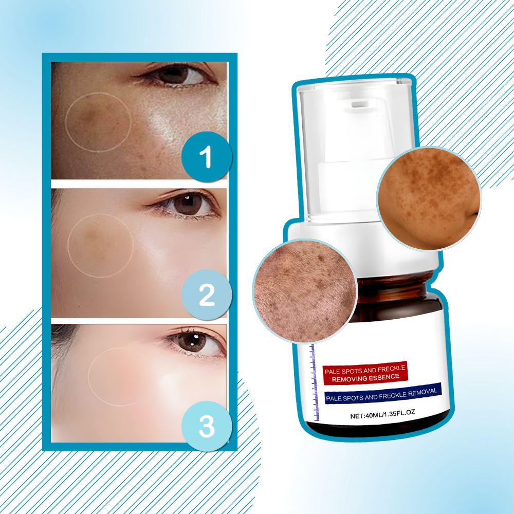 Skin Brightening Silky Kojic Serum - Ozerty