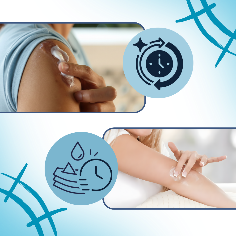 Scar Hydrating Silicone Cream - Ozerty