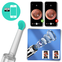 Smart Ear Wax Removal Camera