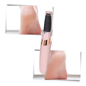 Electric Callus Remover