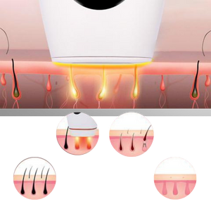 IPL Laser Hair Remover Handset