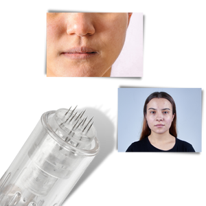 Dermal Microneedling Pen